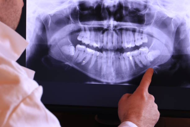 Best Urgent Dental Care for Toothache in Rocky Mount, NC