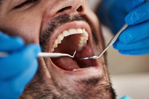 Best Weekend Emergency Dentist in Rocky Mount, NC